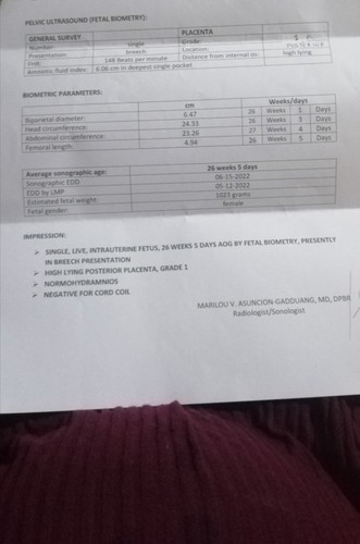 Lampas na sa due date