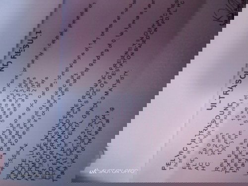 Ultrasound result normal ba?