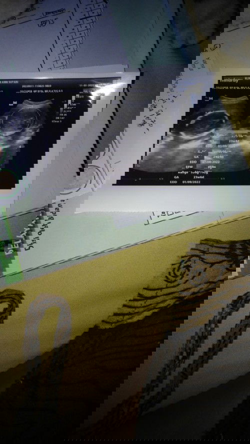 jantung debar kenceng