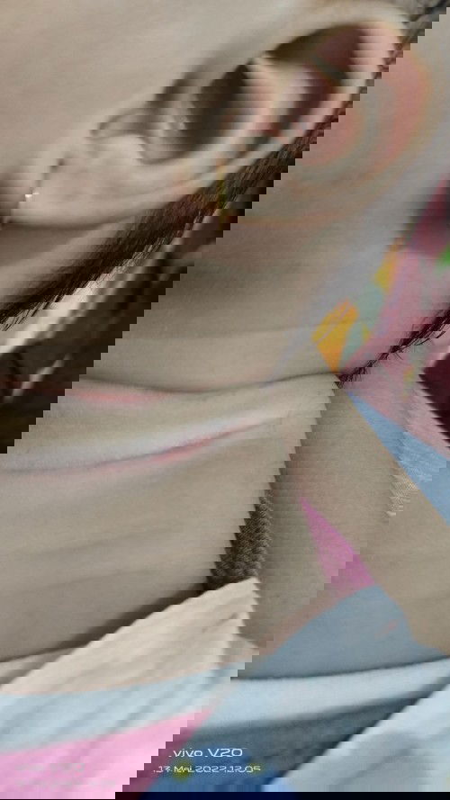 Seperti luka sayatan