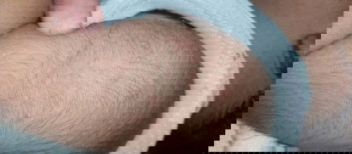 Bintik ditangan leher