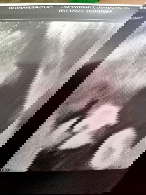 C.A.S at 25 weeks 🥰