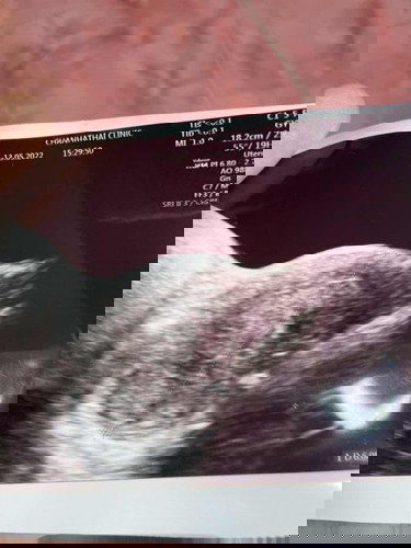 สอบถามแม่ๆค่ะ