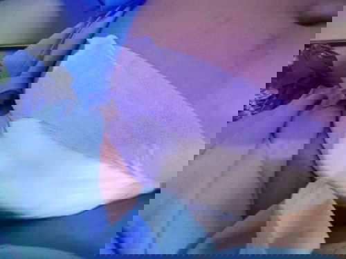 ทำหมันบลอคหลัง