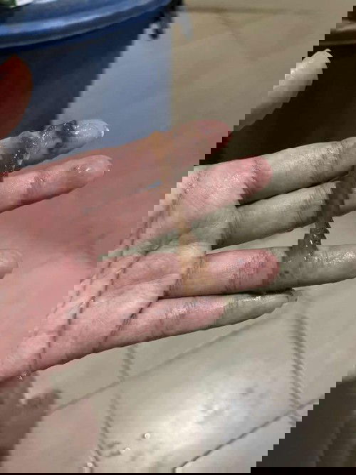 มูกเลือดแบบไหนควรไปโรงบาลคะ