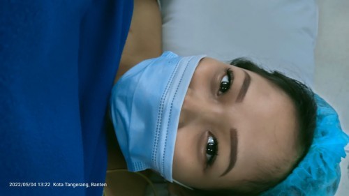 Perjuangan SC Eracs+ Sterill