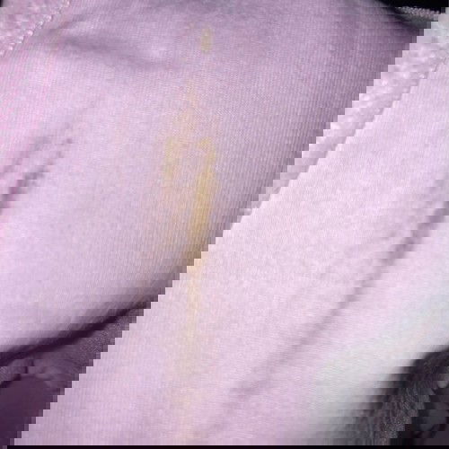 keputihan atau spotting blood?