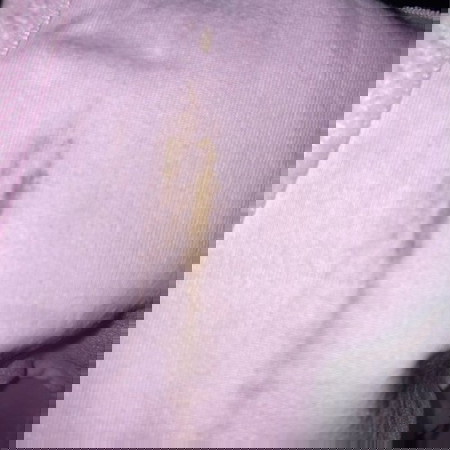 keputihan atau spotting blood?