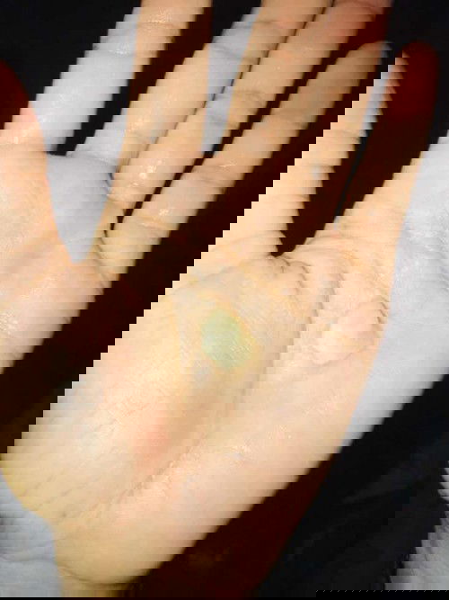 ตอนนี้ท้อง7เดือนกว่า  มีตกขาวออกมาเป็นก้อนๆแบบนี้มันผิดปกติมั้ย