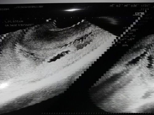 ขอสอบถามหน่อยค่ะ