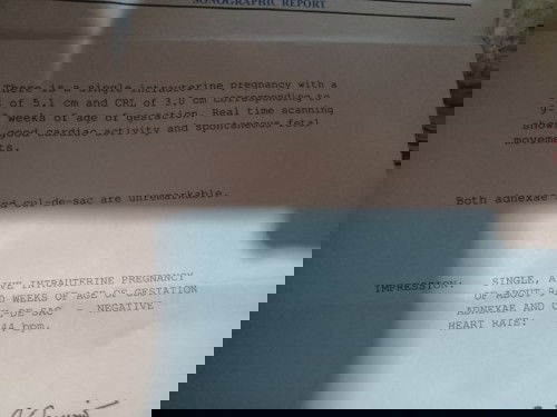 Ask ko Lang po ano po ibig sabihin  Ng adnexae and cul de sac nag pa ultrasound po kasi Ako kahapon