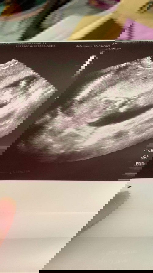 ano po kaya gender niya