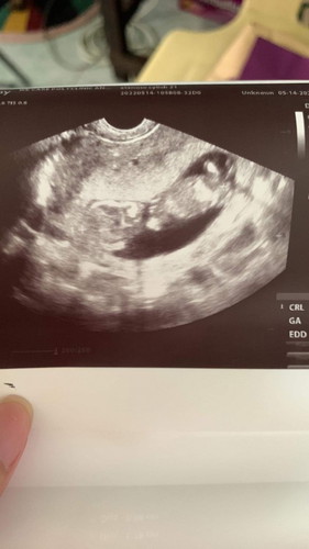 ano po kaya gender niya