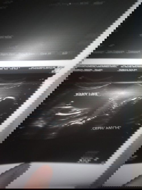 Hehehe Pa check Nmn S Marunong