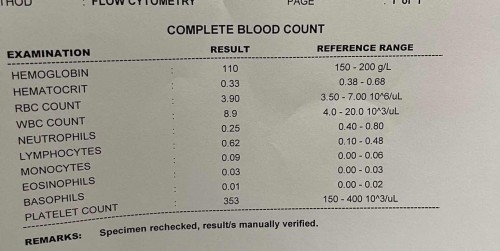 Anemic baby.