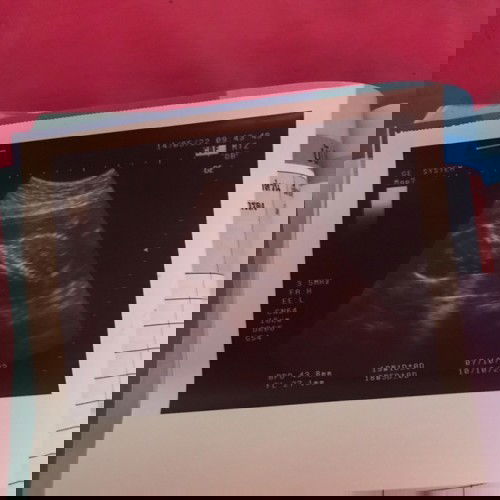 น้องเป็นผญค๊า น้องแข็งแรงดีค๊า