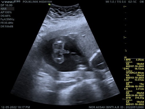 Assalamualaikum.kwn2 semua nk tny.ni boy ke girl.