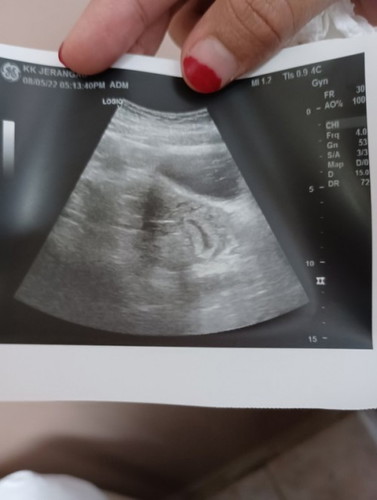 MOMMY ADA PENGALAMAN MCM SAYA?