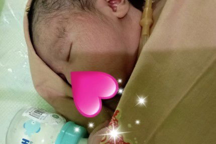 Lahiran 39W3D lewat Induksi + SC