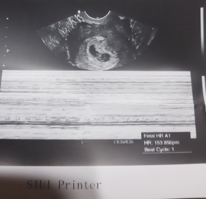 I had spotting last Thursday