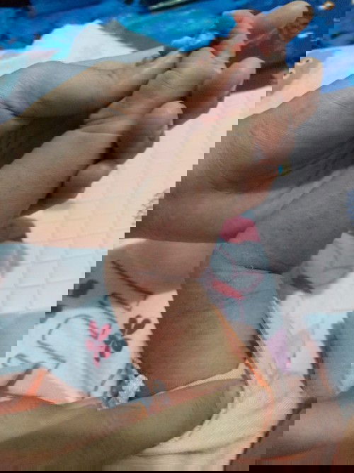 BERCAK MERAH KEMERAHAN