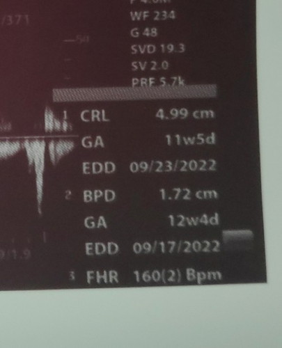 Ultrasound CRL & BPD