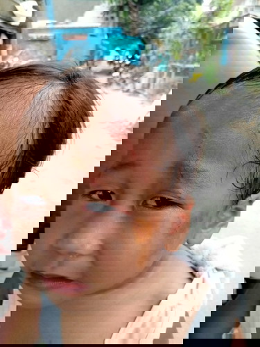 Hello Po ask ko lang Po para sure kung may rabbies Po ba Ang rabbit??nakalmot Po Kasi baby ko..