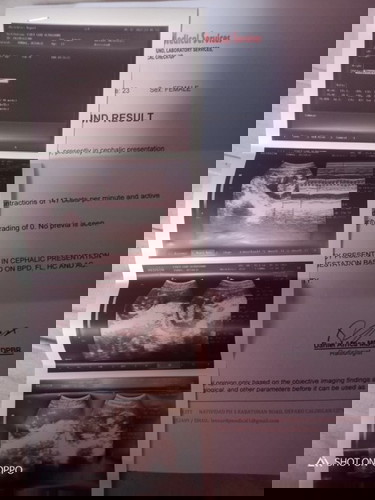 Ultrasound results 15weeks&6days