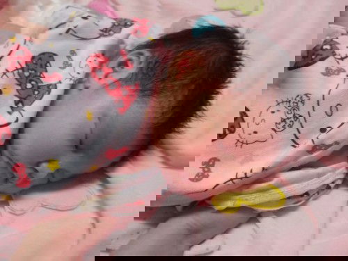 อายุครรภ์37Wเจ็บท้อง3ชมปากมดลูกเปิด8เซน มดลูกเกือบแตก ดีไปรพทัน ท้อง2ไงก็ต้องผ่าให้แม่เจ็บ2ต่อสะงั้น