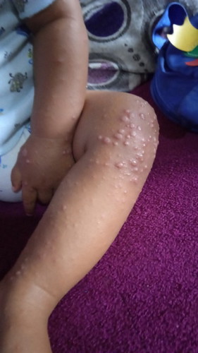 Flu singapure