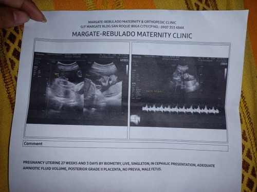 First time mommy po ako, ano po meaning ng no previa sa ultrasound? 27 weeks 6days preggy po ako