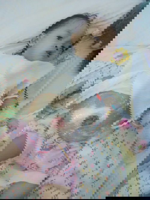 Oprasi colostomy bayi