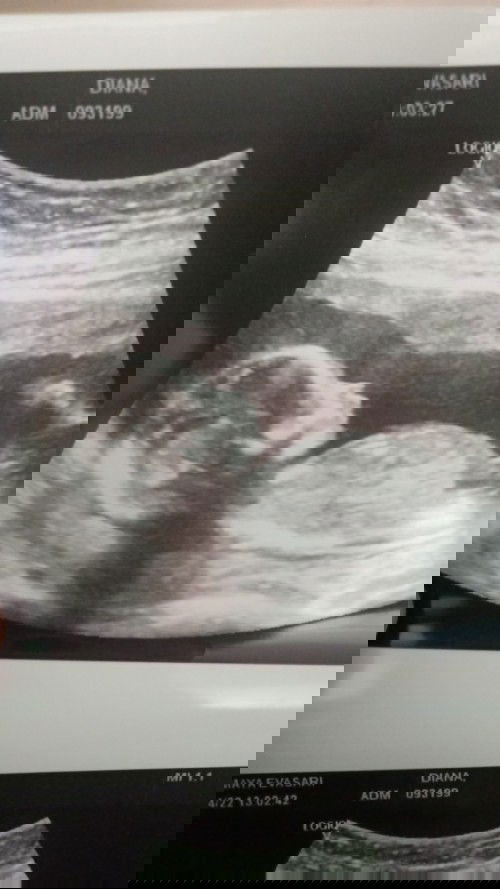 Hpl 3 Oktober kehamilan 20week