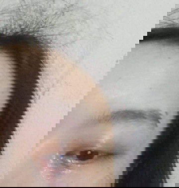 ปวดตาขณะตั้งครรภ์