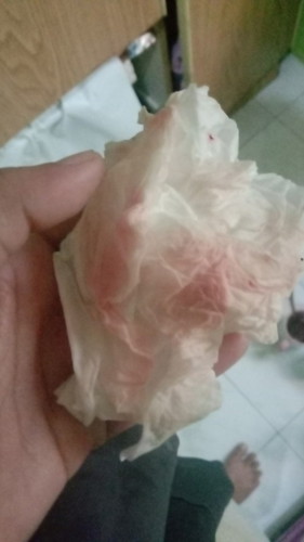 Bun ini knpa ya Bun? Efek capek atau gmna.. tpi nggak ada ngrasain apa² sih.. 🥺🥺 tkut smoga baik²