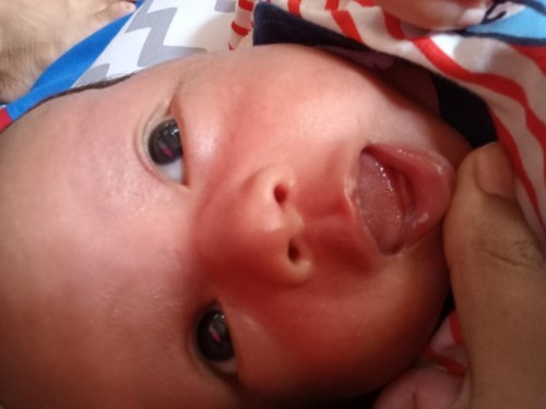 Bibir putih