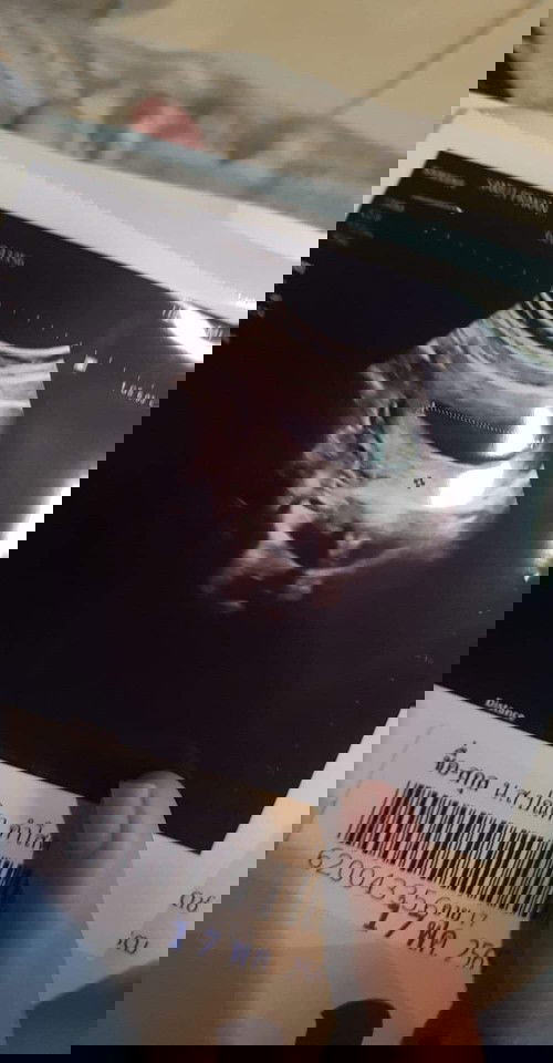 ขอคำแนะนำหย่อยค่ะ