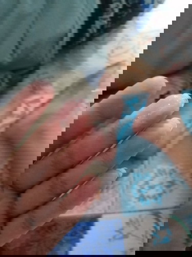 ใช่มูกเลือดไหมค่ะ