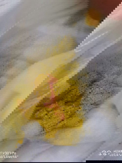 Najis bayi ada lendir+darah