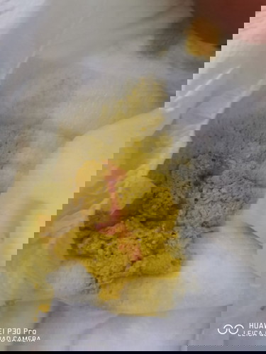 Najis bayi ada lendir+darah