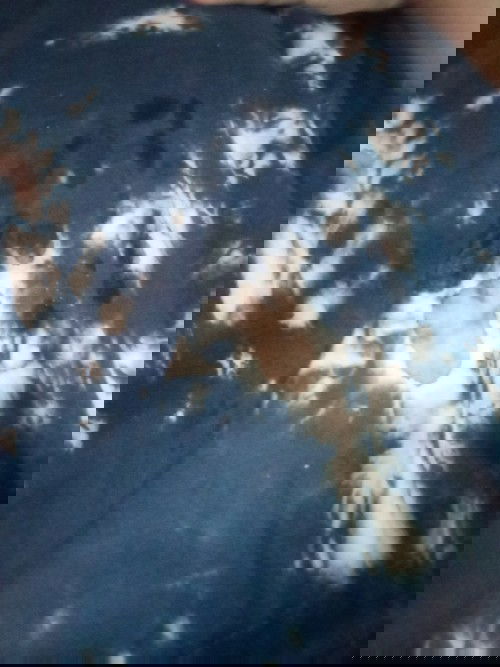 Keluar air pada puting saat hamil