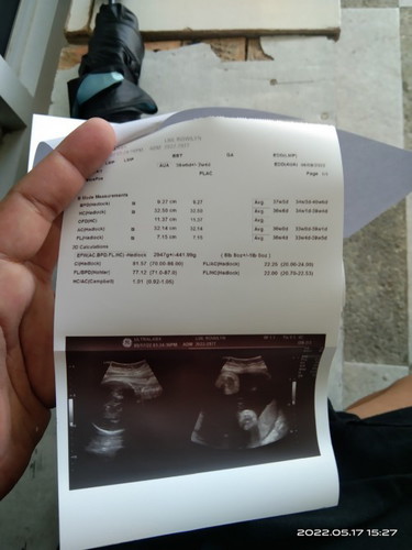 Hello po normal lang po ba itong results ng ultrasound ko po ?