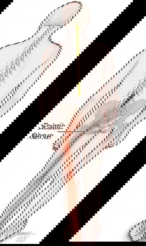 May mga nakakaranas din po ba sainyo ng Sciatica Pain? Paano niyo po nae-ease yung sakit?