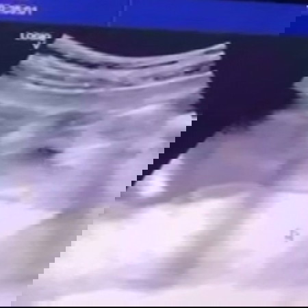 ผู้ชายไหมคะแม่ๆ แหลมออกมาเลย
20Week หมอบอกว่ายังไม่ชัดเจนเท่าไหร่
แต่น่าจะไม่พลาดผู้ชายค่ะ😂
#ท้องสองอยากได้ลูกสาว🥹