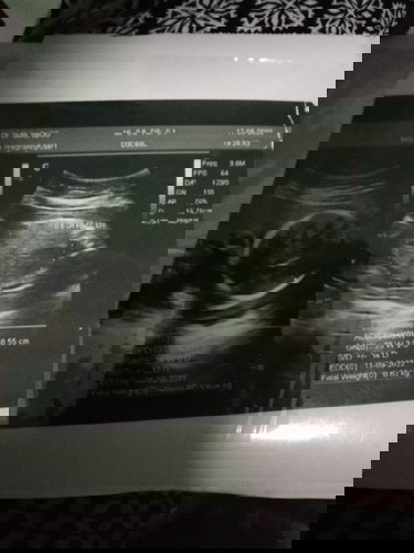 Klo di aplikasi msiha 22 minggu 3hri. Tp pas usg dokter blg udh 24 mnggu. Mnrut bunda2 gmn?