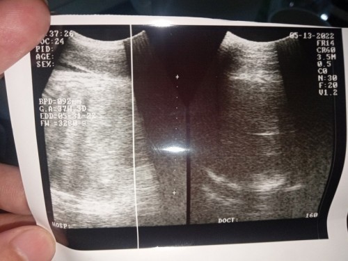 Hasil USG 38w3d