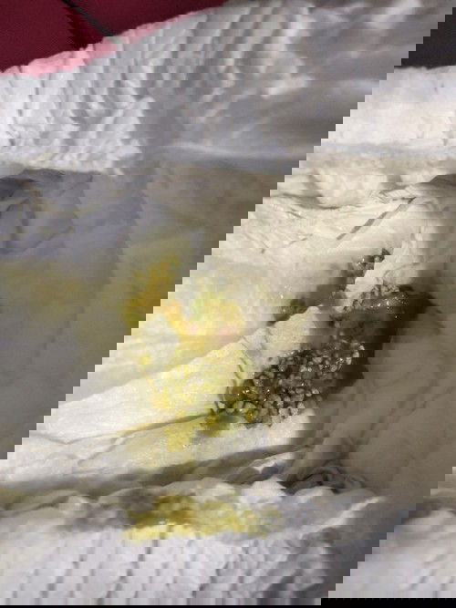 ลูกถ่ายผิดปกติ