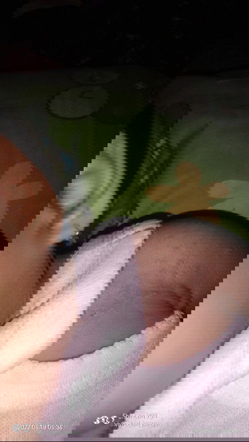 ada yang pernahkah anaknya keluar bintik merah seperti di foto?