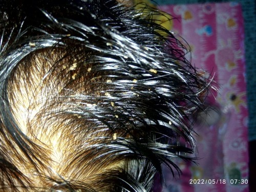 Kerak di kulit kepala bayik