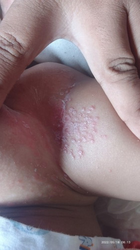 1อาทิตแล้วยังไม่ดีเลย